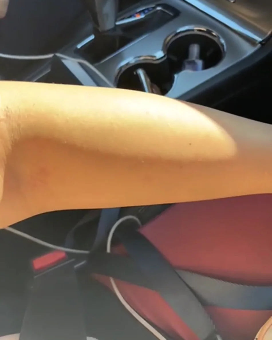 Brazo de una clienta después de usar la crema